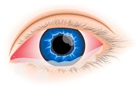 Allergic Conjunctivitis Market Report Forecasts Dynamic Growth Through 2035