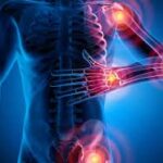 Bioelectric Medicine Market Report Forecasts Dynamic Growth Through 2035