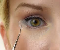 Ophthalmology Amniotic Membranes Market Report Forecasts Dynamic Growth Through 2035