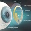 Smart Contact Lenses Market Report Forecasts Dynamic Growth Through 2035