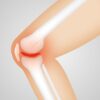 Japan Total Knee Arthroplasty Market Opportunities and Regional Insights 2025–2035