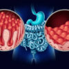 Europe Inflammatory Bowel Disease Therapeutics Market Growth, Drivers, and Opportunities 2035