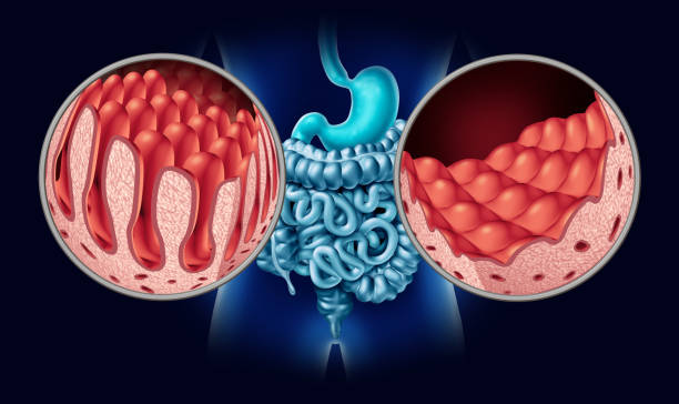 Europe Inflammatory Bowel Disease Therapeutics Market Growth, Drivers, and Opportunities 2035