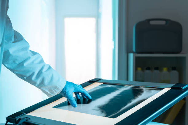 China Medical XRay Film Processor Market Size, Share, Growth Drivers Report 2035
