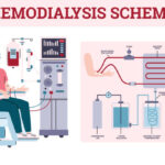 Haemodialysis Concentrates Market Study: Comprehensive Segmentation and Forecast