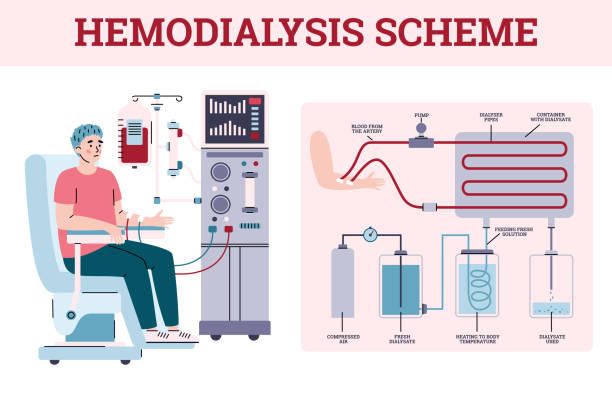 Haemodialysis Concentrates Market Study: Comprehensive Segmentation and Forecast