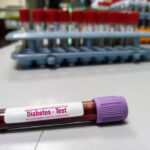 China Diabetes Laboratory Immunoassays Market Industry Analysis, Size, and Demand Forecast