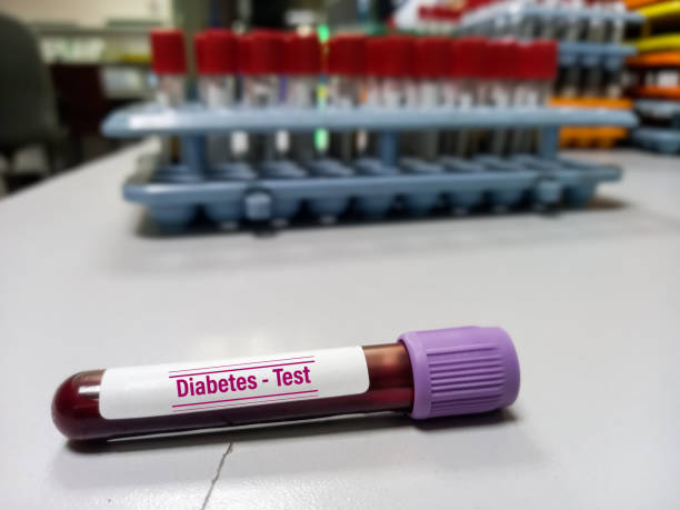 China Diabetes Laboratory Immunoassays Market Industry Analysis, Size, and Demand Forecast