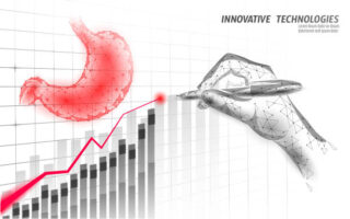 Intragastric Balloon Market Trends: Emerging Innovations and Dynamics