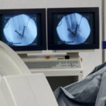 Europe Extracorporeal Lithotripter Market Opportunities and Regional Insights 2025–2035