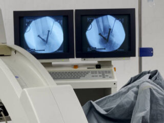 Europe Extracorporeal Lithotripter Market Opportunities and Regional Insights 2025–2035