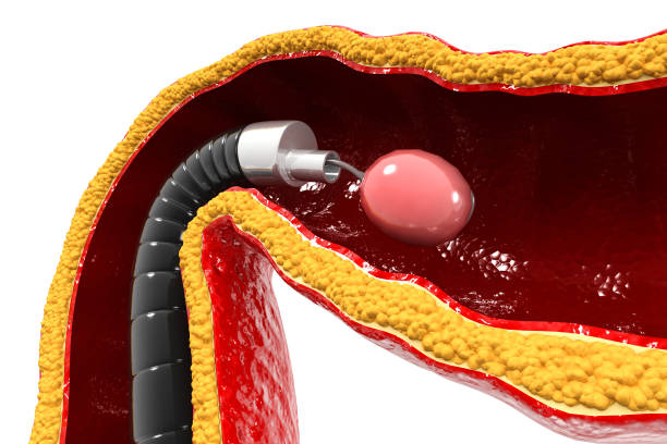 Europe Minimally Invasive Spine Technologies Market Trends and Strategic Analysis 2025–2035
