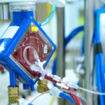 Haemodialysis Concentrates Market Study: Comprehensive Segmentation and Forecas