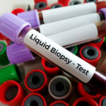 Europe Biopsy Devices Market Opportunities and Regional Insights 2025–2035