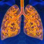 US Respiratory Tract Infection Treatment Market Strategic Insights and Business Growth Potential