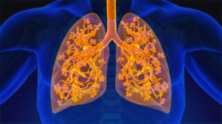 US Respiratory Tract Infection Treatment Market Strategic Insights and Business Growth Potential