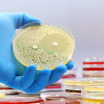 Microbiology Culture Market Report: Comprehensive Overview of Developments