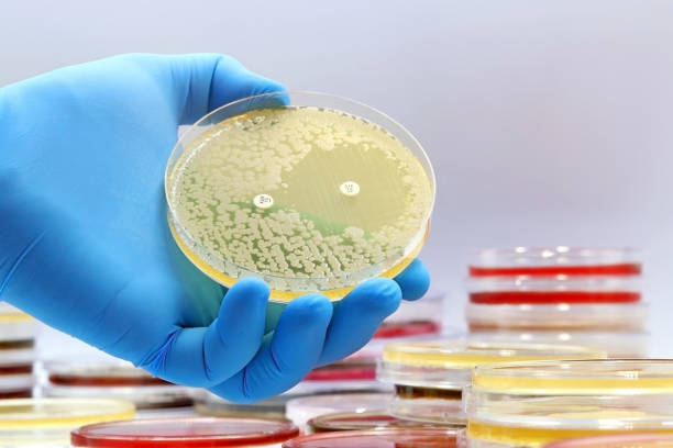 Microbiology Culture Market Report: Comprehensive Overview of Developments