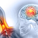 US Neuroendoscopy Market Outlook 2025–2035: Trends and Forecast