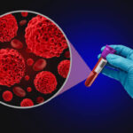 Japan Blood Testing Market Strategic Insights and Business Growth Potential