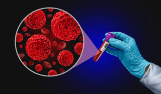 Japan Blood Testing Market Strategic Insights and Business Growth Potential