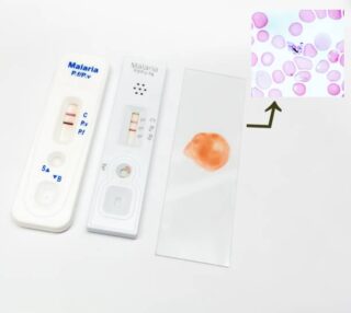 Malaria Rapid Diagnostic Tests (RDTS) Market Innovations: Trends and Strategic Opportunities