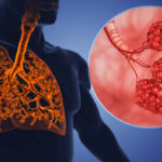 Japan Pain Management Drugs Market Opportunities and Regional Insights 2025–2035