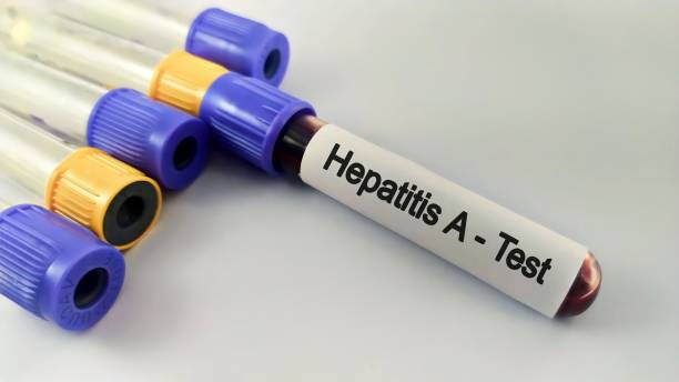 Hepatitis Test Solution Market Strategies: Competitive Insights for Expansion