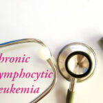 China Chronic Lymphocytic Leukemia Therapeutics Market Size, Share, Growth Drivers Report 2035