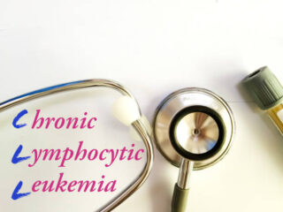 China Chronic Lymphocytic Leukemia Therapeutics Market Size, Share, Growth Drivers Report 2035