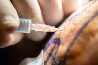 Japan Post Anaesthesia Care Unit Device (PACU) Market Trends and Strategic Analysis 2025–2035