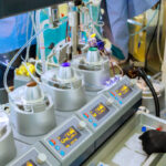 China Artificial Heart Lung Machines Market Strategic Insights and Business Growth Potential