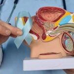 China Prostate Cancer Therapeutics Market Outlook 2025–2035: Trends and Forecast