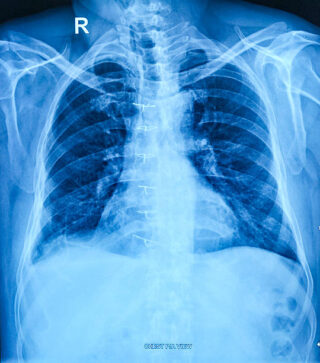 Japan Medical Imaging Information System Market Insights: Regional and Segmental Analysis