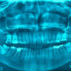 Japan Dental Imaging Equipment Market Opportunities and Regional Insights 2025–2035