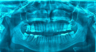 Japan Dental Imaging Equipment Market Opportunities and Regional Insights 2025–2035