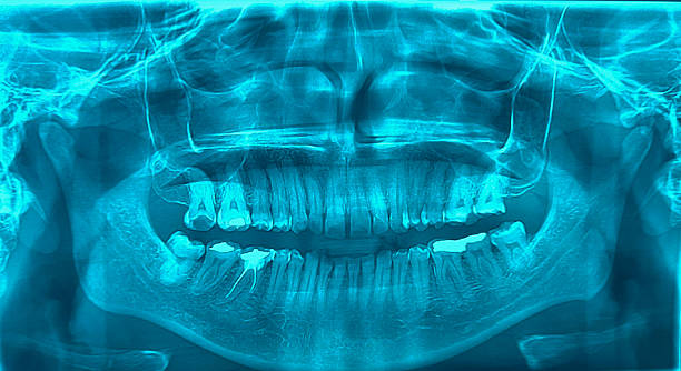 Japan Dental Imaging Equipment Market Opportunities and Regional Insights 2025–2035