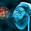 China Chronic Kidney Disease Drug Market Forecast: Global Growth Outlook till 2035