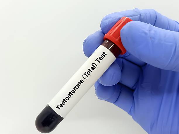 US Premature Ejaculation Treatment Market Strategic Insights and Business Growth Potential