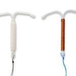 Japan Intrauterine Devices Market Size & Revenue Analysis 2035