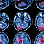 Japan Cancer Imaging System Market Trends and Strategic Analysis 2025–2035