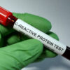 C-Reactive Protein Test Market Report: Comprehensive Overview of Developments