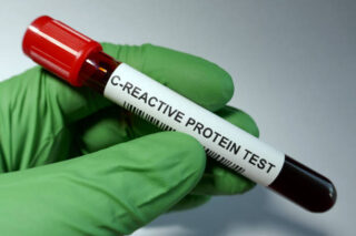 C-Reactive Protein Test Market Report: Comprehensive Overview of Developments