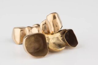 Japan Bronze Dental Flasks Market Reset: Analyzing Economic Stressors and Trade Policy Shocks