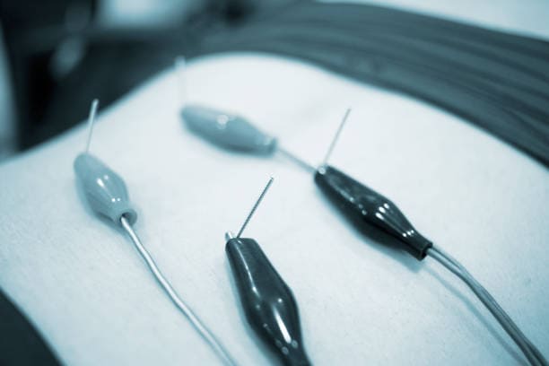 china Nerve Stimulators Market Industry at a Crossroads: Recession Threats and the Future of Global Trade