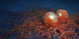 Japan Radiation Therapy Software Market Intelligence Report: Recession Readiness and Tariff Implications