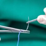 china Suture Thread Market Industry Forecast: Navigating the Trade-Off Era Amid Global Economic Uncertainty
