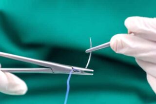 china Suture Thread Market Industry Forecast: Navigating the Trade-Off Era Amid Global Economic Uncertainty